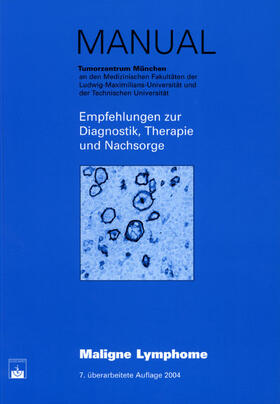 Emmerich |  Maligne Lymphome | Buch |  Sack Fachmedien