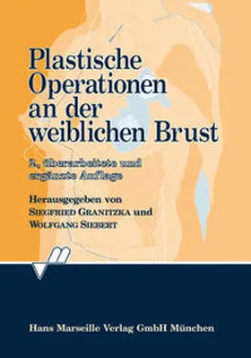 Granitzka / Siebert | Plastische Operationen an der weiblichen Brust | Buch | 978-3-88616-124-9 | sack.de