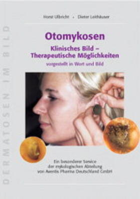 Ulbricht / Leithäuser |  Otomykosen: Klinisches Bild - Therapeutische Möglichkeiten | Buch |  Sack Fachmedien