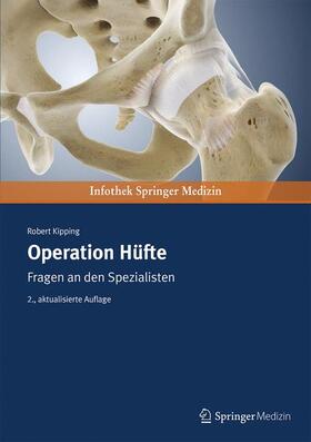Kipping |  Operation Hüfte | Buch |  Sack Fachmedien