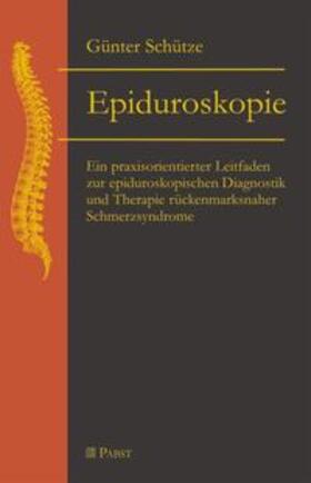 Schütze |  Epiduroskopie | Buch |  Sack Fachmedien