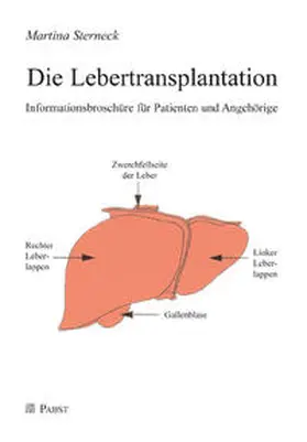 Sterneck |  Die Lebertransplantation | Buch |  Sack Fachmedien