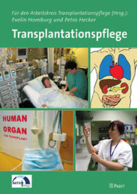 Homburg / Arbeitskreis Transplantationspflege / Hecker |  Transplantationspflege | Buch |  Sack Fachmedien