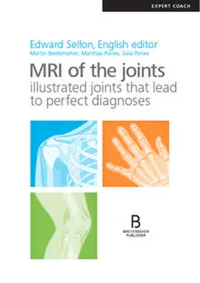 Sellon / Breitenseher / Pones |  MRI of the joints | Buch |  Sack Fachmedien