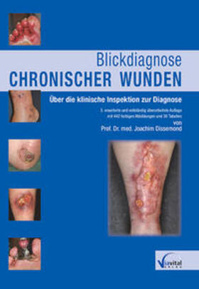 Dissemond |  Blickdiagnose chronischer Wunden | Buch |  Sack Fachmedien