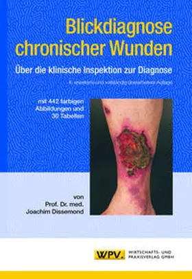 Dissemond |  Blickdiagnose chronischer Wunden | Buch |  Sack Fachmedien