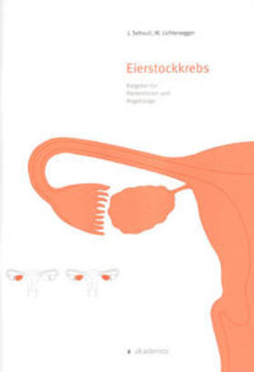 Sehouli / Lichtenegger |  Eierstockkrebs | Buch |  Sack Fachmedien