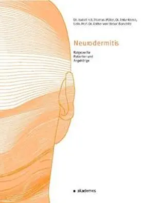 Fell / Müller / Reese |  Neurodermitis. | Buch |  Sack Fachmedien