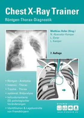 Hofer / Kamper / Abanador-Kamper |  Chest-X-Ray Trainer | Buch |  Sack Fachmedien