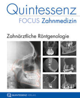 Schulze | Zahnärztliche Röntgenologie | Buch | 978-3-938947-25-8 | sack.de