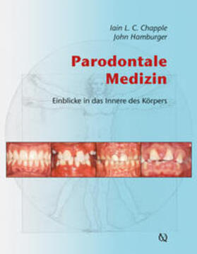 Chapple / Hamburger |  Parodontale Medizin | Buch |  Sack Fachmedien
