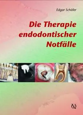 Schäfer |  Die Therapie endodontischer Notfälle | Buch |  Sack Fachmedien