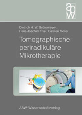 Grönemeyer / Thiel / Moser |  Tomographische periradikuläre Mikrotherapie | Buch |  Sack Fachmedien