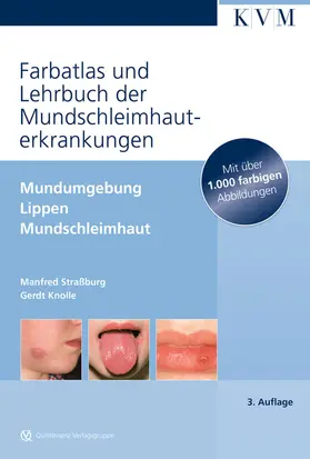 Straßburg / Knolle |  Farbatlas und Lehrbuch der Mundschleimhauterkrankungen | Buch |  Sack Fachmedien