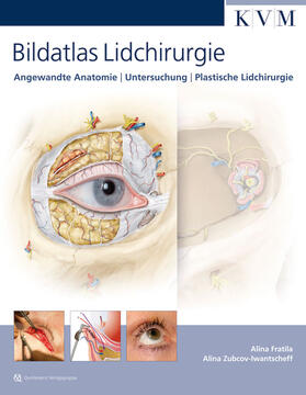 Fratila / Zubcov-Iwantscheff |  Bildatlas Lidchirurgie | Buch |  Sack Fachmedien