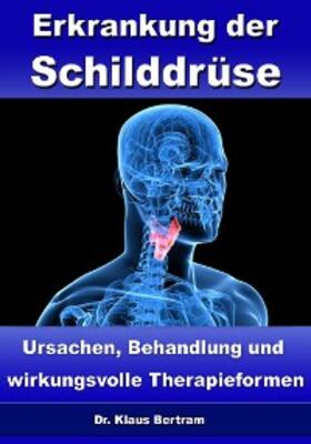 Bertram |  Erkrankung der Schilddrüse - Ursachen, Behandlung und wirkungsvolle Therapieformen | eBook | Sack Fachmedien