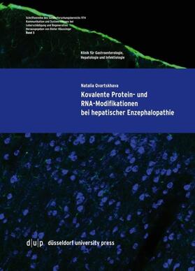 Qvartskhava |  Kovalente Protein- und RNA-Modifikationen bei hepatischer Enzephalopathie | Buch |  Sack Fachmedien