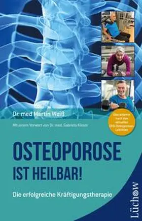 Weiß |  Osteoporose ist heilbar! | eBook | Sack Fachmedien