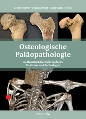 Weber / Wahl / Zink | Osteologische Paläopathologie | Buch | 978-3-96543-314-4 | sack.de