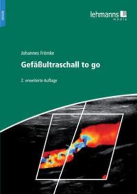 Frömke |  Gefäßultraschall to go | Buch |  Sack Fachmedien