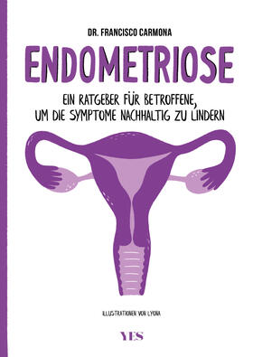Carmona |  Endometriose | Buch |  Sack Fachmedien