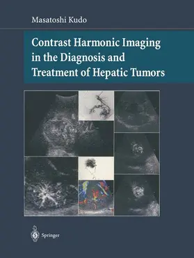 Kudo |  Contrast Harmonic Imaging in the Diagnosis and Treatment of Hepatic Tumors | Buch |  Sack Fachmedien