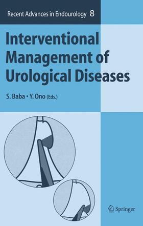 Ono / Baba |  Interventional Management of Urological Diseases | Buch |  Sack Fachmedien