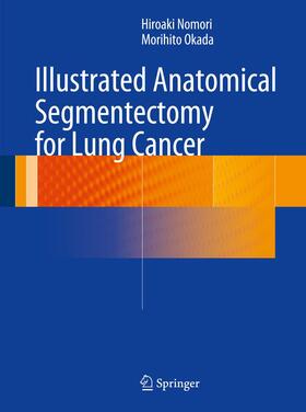 Okada / Nomori |  Illustrated Anatomical Segmentectomy for Lung Cancer | Buch |  Sack Fachmedien