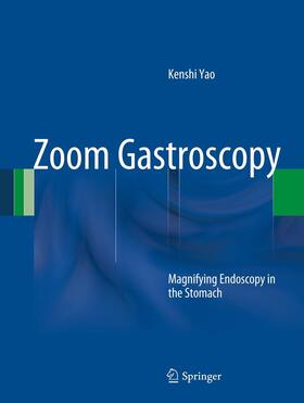 Yao |  Zoom Gastroscopy | eBook | Sack Fachmedien