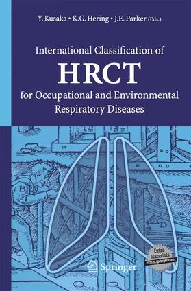 Kusaka / Parker / Hering |  International Classification of HRCT for Occupational and Environmental Respiratory Diseases | Buch |  Sack Fachmedien