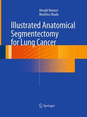 Okada / Nomori |  Illustrated Anatomical Segmentectomy for Lung Cancer | Buch |  Sack Fachmedien