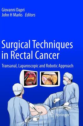 Marks / Dapri |  Surgical Techniques in Rectal Cancer | Buch |  Sack Fachmedien
