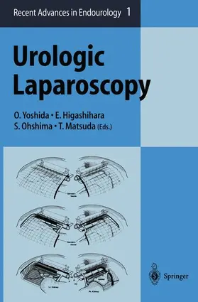 Yoshida / Matsuda / Higashihara |  Urologic Laparoscopy | Buch |  Sack Fachmedien