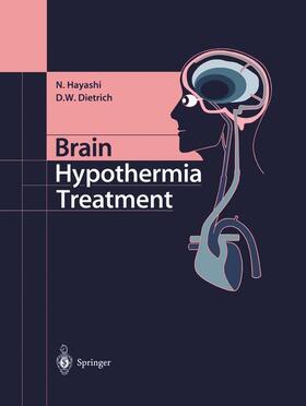 Dietrich / Hayashi |  Brain Hypothermia Treatment | Buch |  Sack Fachmedien