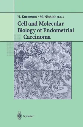 Nishida / Kuramoto |  Cell and Molecular Biology of Endometrial Carcinoma | Buch |  Sack Fachmedien