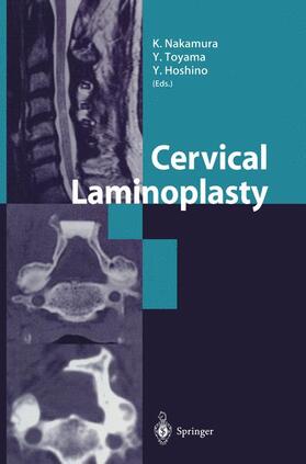 Nakamura / Hoshino / Toyama |  Cervical Laminoplasty | Buch |  Sack Fachmedien