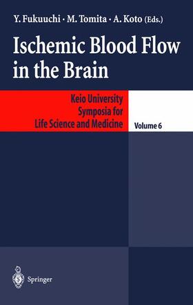 Fukuuchi / Koto / Tomita |  Ischemic Blood Flow in the Brain | Buch |  Sack Fachmedien
