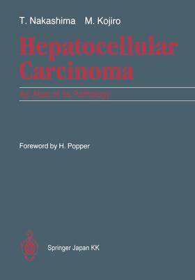 Nakashima / Kojiro |  Hepatocellular Carcinoma | Buch |  Sack Fachmedien