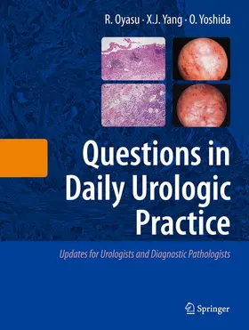 Oyasu / Yoshida / Yang |  Questions in Daily Urologic Practice | Buch |  Sack Fachmedien