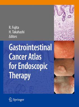 Takahashi / Fujita |  Gastrointestinal Cancer Atlas for Endoscopic Therapy | Buch |  Sack Fachmedien