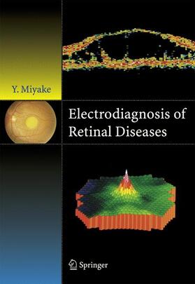 Miyake |  Electrodiagnosis of Retinal Disease | Buch |  Sack Fachmedien