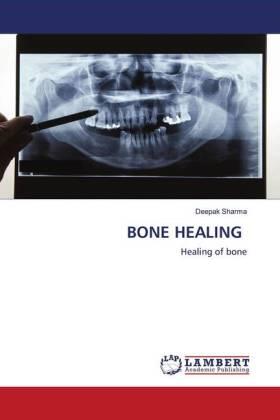 Sharma |  BONE HEALING | Buch |  Sack Fachmedien