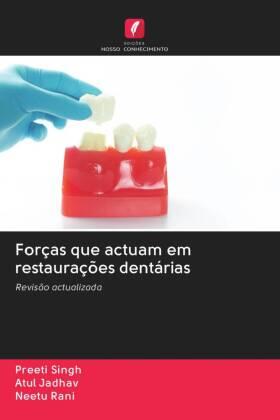 Singh / Jadhav / Rani |  Forças que actuam em restaurações dentárias | Buch |  Sack Fachmedien