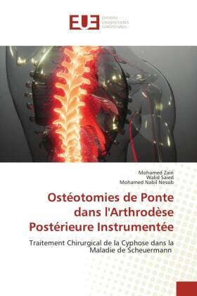 Zairi / Saied / Nessib |  Ostéotomies de Ponte dans l'Arthrodèse Postérieure Instrumentée | Buch |  Sack Fachmedien