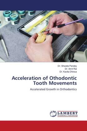 Pandey / Rai / Dhinsa |  Acceleration of Othodontic Tooth Movements | Buch |  Sack Fachmedien