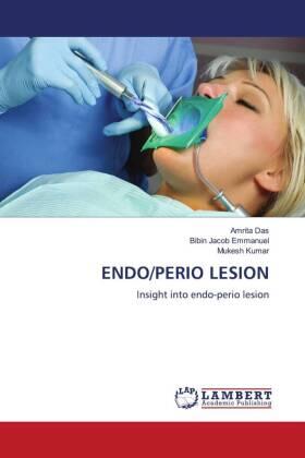 Das / Emmanuel / Kumar |  ENDO/PERIO LESION | Buch |  Sack Fachmedien