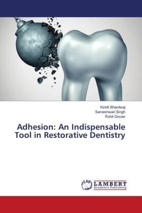 Bhardwaj / Singh / Grover |  Adhesion: An Indispensable Tool in Restorative Dentistry | Buch |  Sack Fachmedien