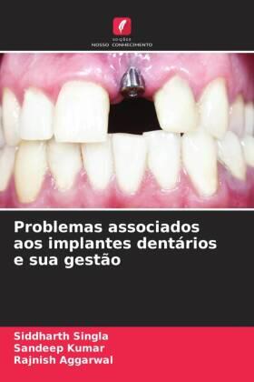 Singla / Kumar / Aggarwal |  Problemas associados aos implantes dentários e sua gestão | Buch |  Sack Fachmedien