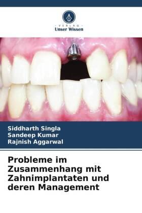 Singla / Kumar / Aggarwal |  Probleme im Zusammenhang mit Zahnimplantaten und deren Management | Buch |  Sack Fachmedien