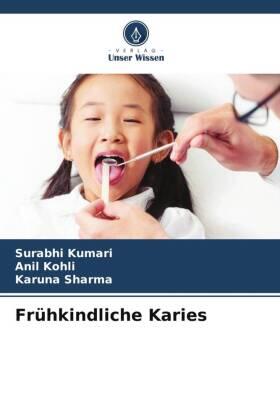 Kumari / Kohli / Sharma |  Frühkindliche Karies | Buch |  Sack Fachmedien